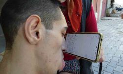 Engelleri burnuyla aştı: Telefonuyla hayata tutundu