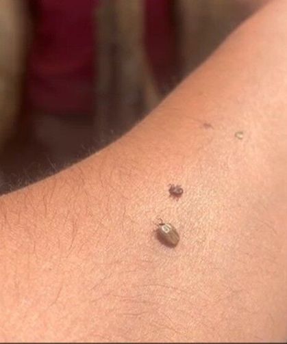 Kene popülasyonu arttı, uzmanlar tedbir çağrısı yaptı