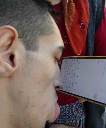 Engelleri burnuyla aştı: Telefonuyla hayata tutundu