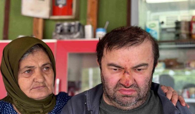 Yüzde 90 engelli vatandaş acımasızca darp edildi