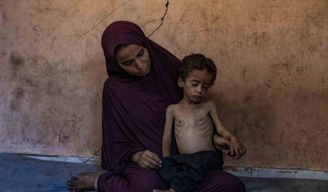 Gazze’de açlık nedeniyle hayatını kaybedenlerin sayısı 113’e yükseldi