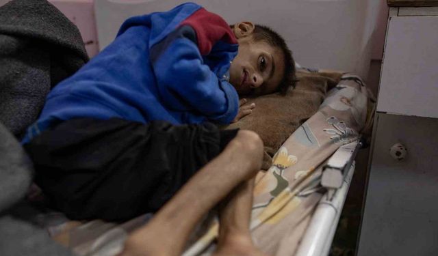 Gazze’de son 24 saatte 10 sivil açlıktan öldü