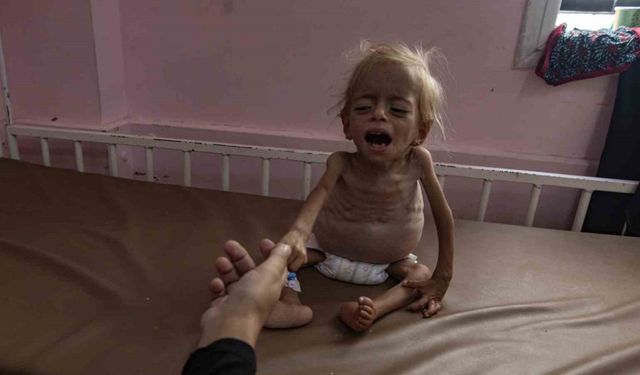 Gazze’de 8 sivil daha açlık nedeniyle hayatını kaybetti