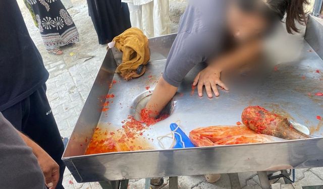 Kız çocuğu elini salça makinesine kaptırdı