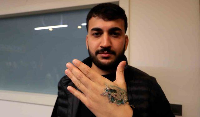 Dövme sildirmek isterken kabusu yaşadı, elindeki dokular öldü