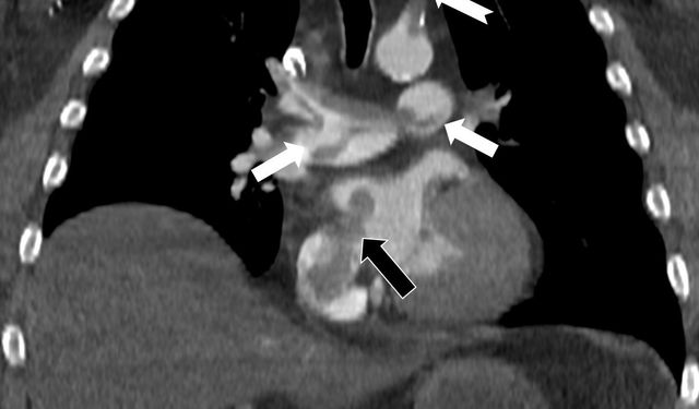 Tekden'de başarılı çalışmalara imza atan radyoloji uzmanından hayati tespit