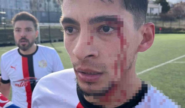 Maç sonrası saha içi savaş alanına döndü, 3 futbolcu hastanelik oldu