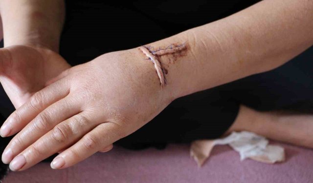 Diyarbakır'da dehşet: Nikahlı eşini 30 yerinden bıçakladı