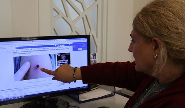 Dr. Sibel Ünlü: ‘ Ülkemizde Kırım Kon Kongo Kanamalı Ateş hastalığında 2002-2025 arasında vaka-ölüm oranı yüzde 4,8’