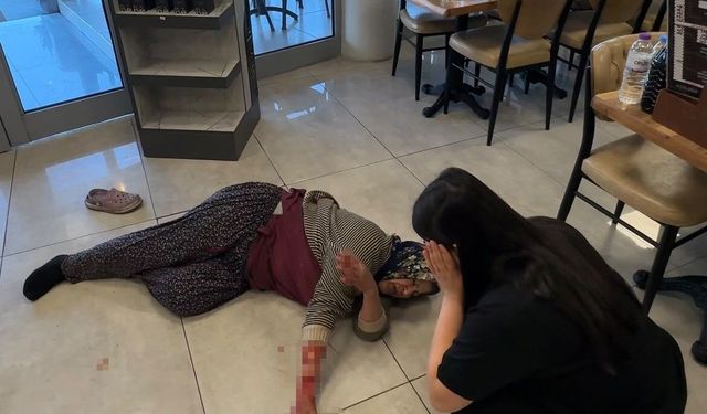 Tekmelere aldırmayan köpek kadının kolunu kopardı