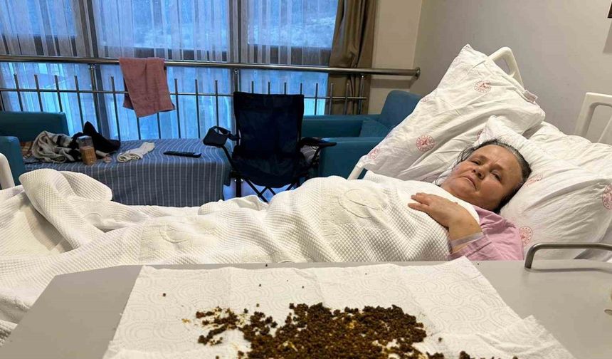 Hastadan çıkan taşları sayamadılar