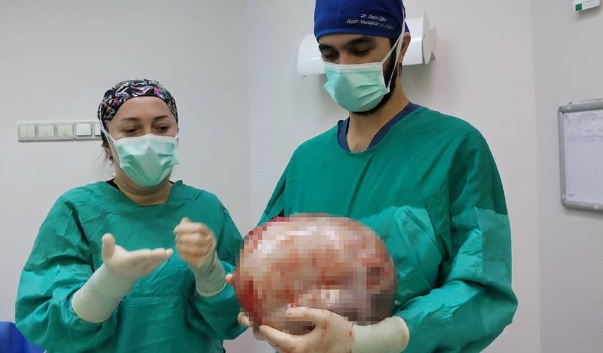 Karnı 2 ayda 9 aylık hamile gibi büyüyen kadının içinden karpuz kadar kitle çıkarıldı