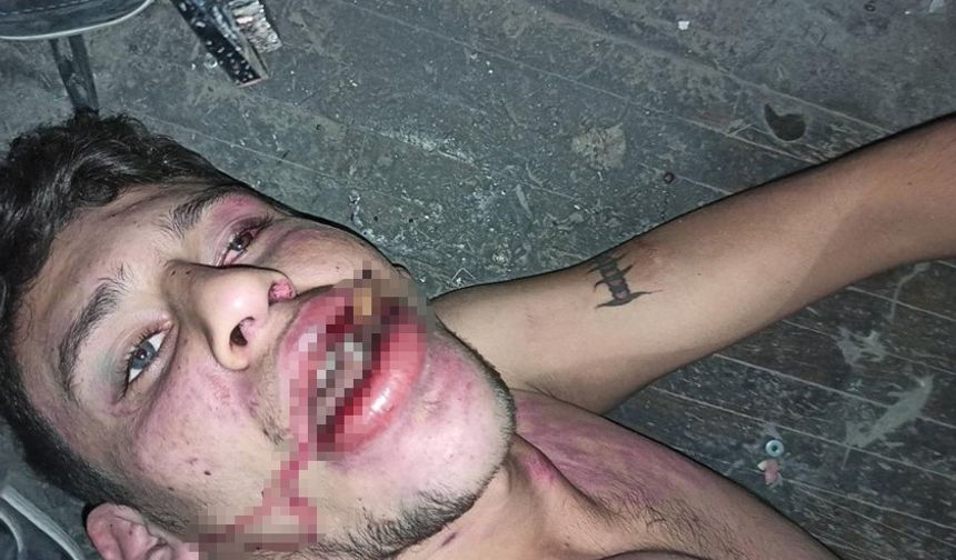 Hamam böceği yedirilen gencin dosyasında karar: Yağmadan beraat, hürriyeti tehditten 6 yıl 12 ay ceza