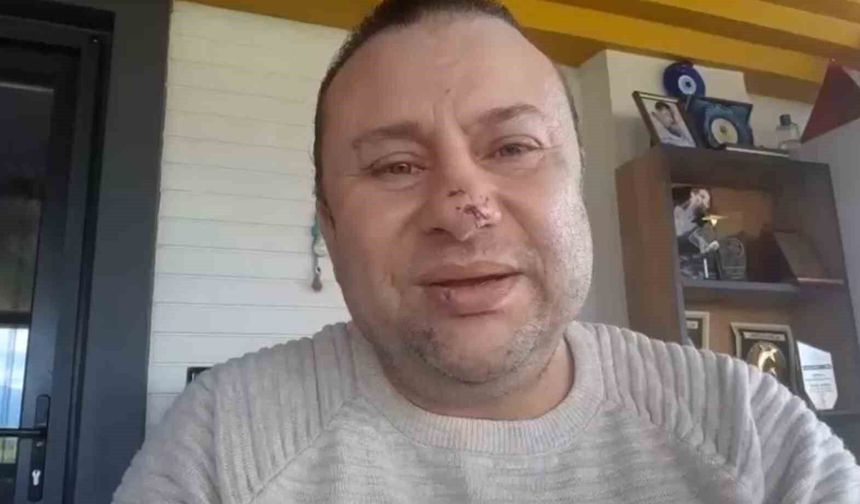 Pitbull saldırısına uğrayan Onur Akay o anları anlattı: 'Ben ölümden döndüm'