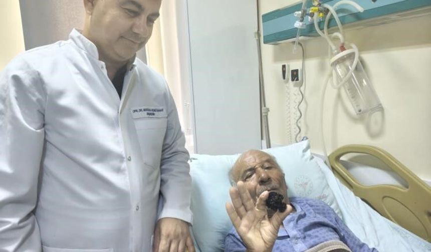 Bozyazı'da 4 santimetrelik mesane taşı tek parça halinde çıkarıldı.