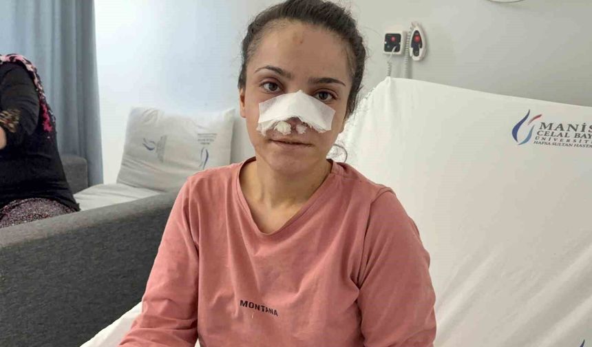 Eşinin kopardığı burnu başarılı operasyonla yerine dikildi
