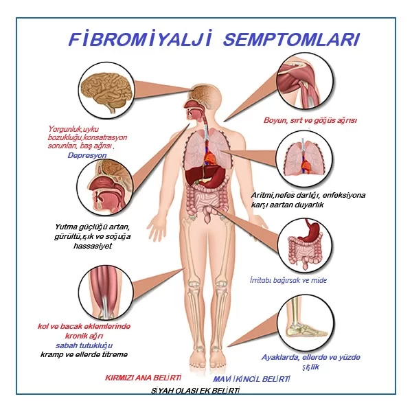 Fibromiyalji Semptomlari1